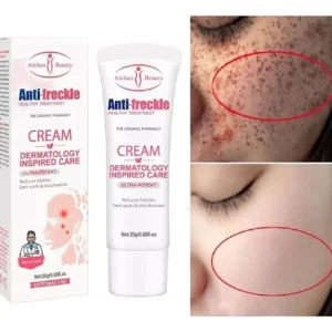 CREMA PARA MANCHAS Y PECAS