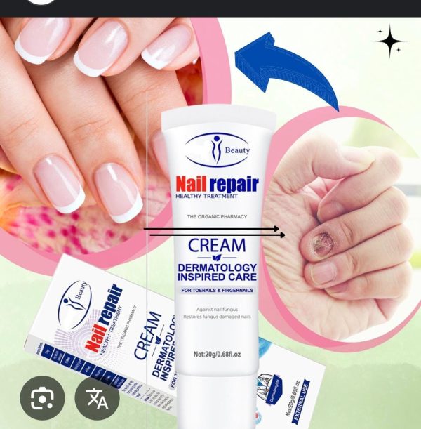 CREMA HONGOS DE UÑAS