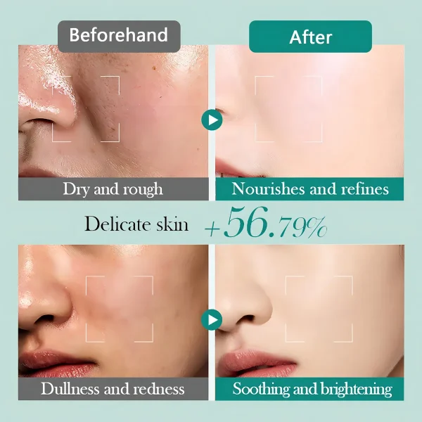 SET DE SKIN CARE BIOAQUA ACIDO HIALURONICO - Imagen 2